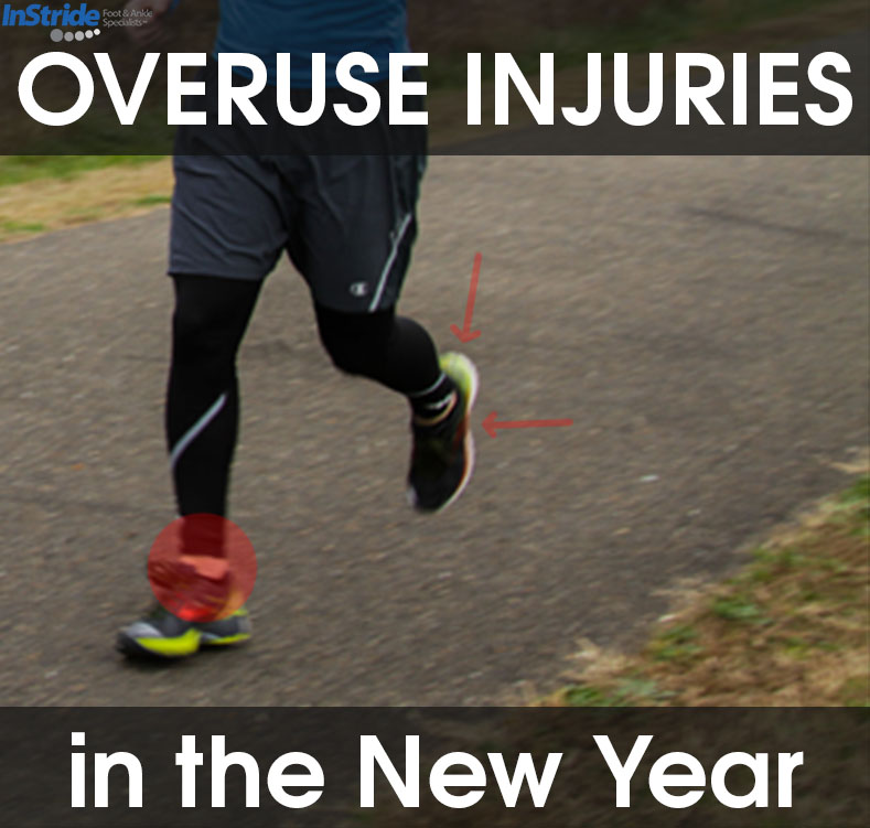 You are currently viewing Overuse Injuries – Exercising “Too Much Too Fast” in the New Year