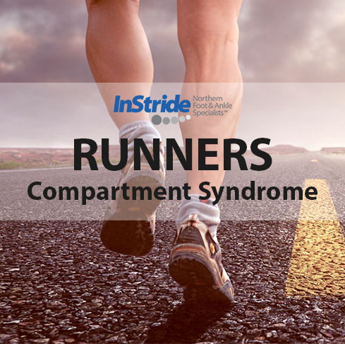 You are currently viewing Compartment Syndrome in Runners