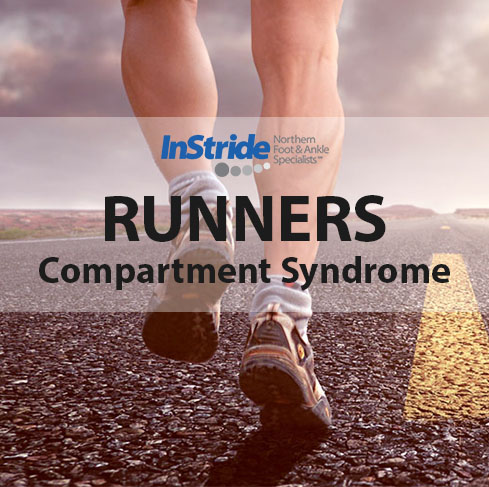 Read more about the article Compartment Syndrome in Runners