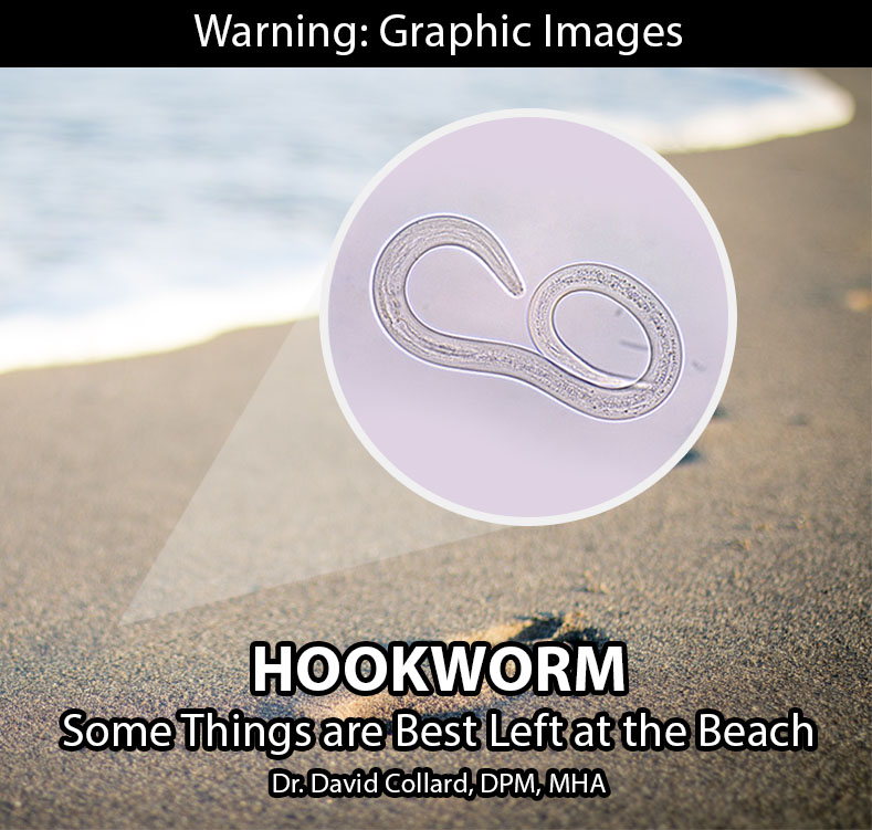 Read more about the article HOOKWORM: Some Things are Best Left at the Beach