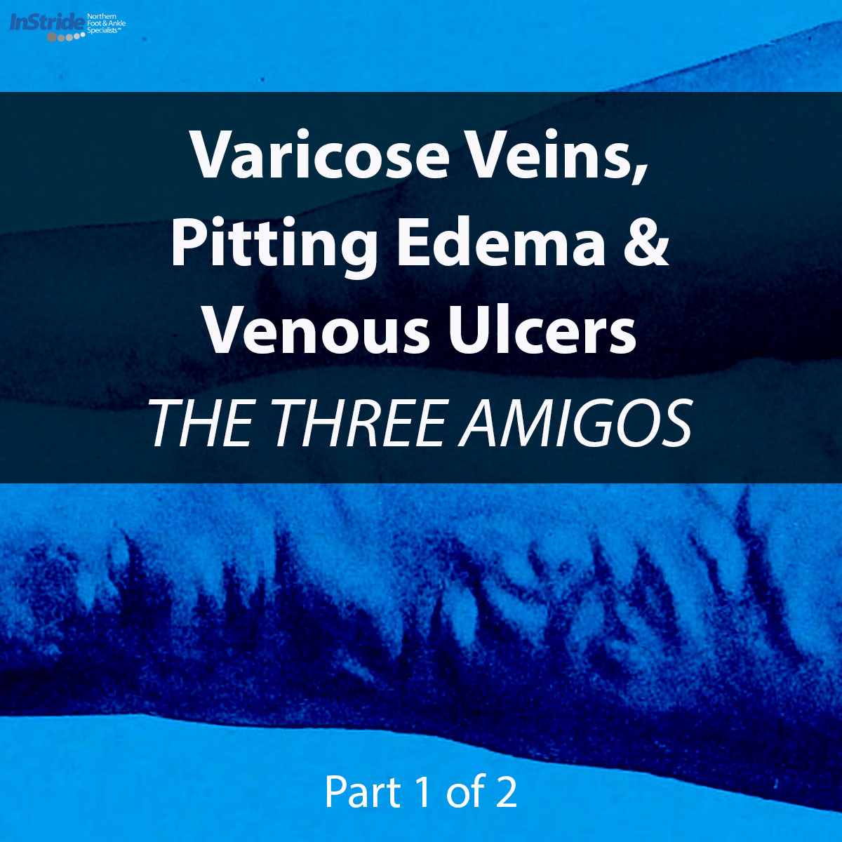 Read more about the article Varicose Veins, Pitting Edema and Venous Ulcers: The Three Amigos – Part 1 of 2